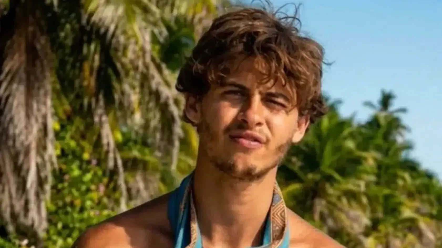 Genç yarışmacı bacağını kaybetti! Survivor yarışmacısının son durumu ne? Kaza nasıl oldu?