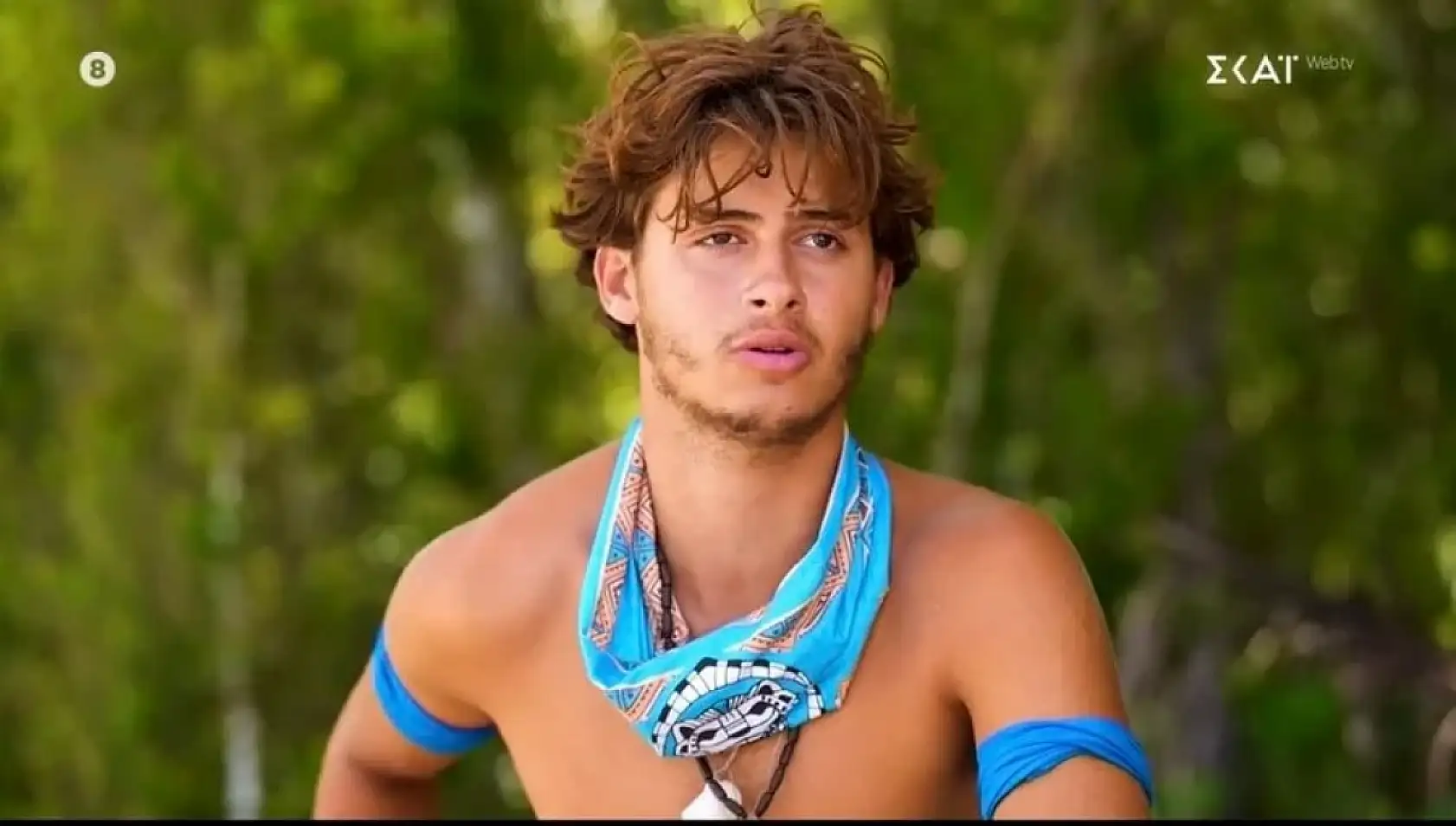 Genç yarışmacı bacağını kaybetti! Survivor yarışmacısının son durumu ne? Kaza nasıl oldu?