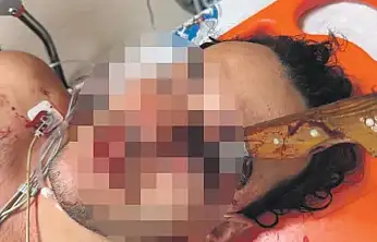 Dehşetin yaşı 17! Konya'da peş peşe bıçaklı saldırı!