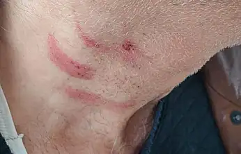 Konya'da aile hekimi görevi başında saldırıya uğradı