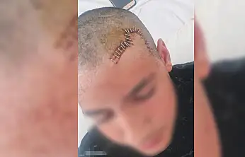 Konya'da arkadaşının kafatasını parçalayan çocuk ile ilgili flaş karar!