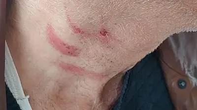 Konya'da aile hekimi görevi başında saldırıya uğradı