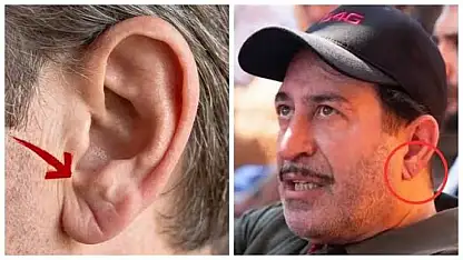 Cem Yılmaz'ın geçirdiği kalp krizi sonrası uzmanından Frank işareti uyarısı