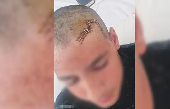 Konya'da arkadaşının kafatasını parçalayan çocuk ile ilgili flaş karar!