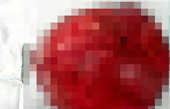 Konya'da tıp mucizesi: Karnından 40 santimetrelik kitle çıkarıldı!