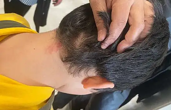 Konya'da veli dehşeti: 8 yaşındaki çocukları dövdükleri fırça sapı 'silah' sayıldı!