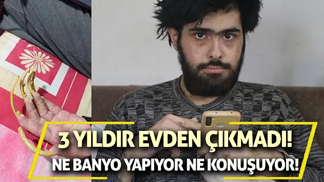 3 Yıldır Evden Çıkmadı! Ne Banyo Yapıyor Ne Konuşuyor!