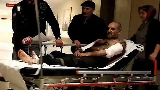Ağaç soyma makinesine kollarını kaptırdı