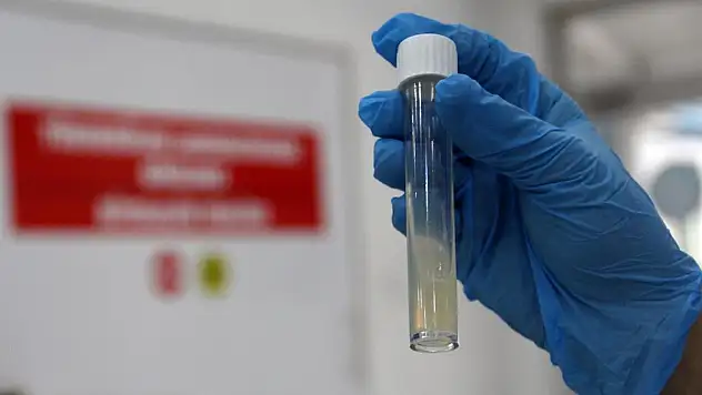 Dünyanın en ölümcül bulaşıcı hastalığı geçen yıl 1,23 milyon can aldı
