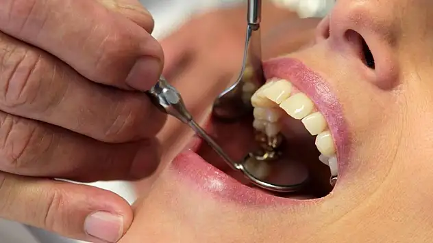 DUS 2. Dönem yerleştirme sonuçları açıklandı