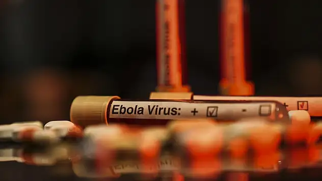 Ebola uyarısı: Tarihin en ölümcül seviyesine ulaşabilir!