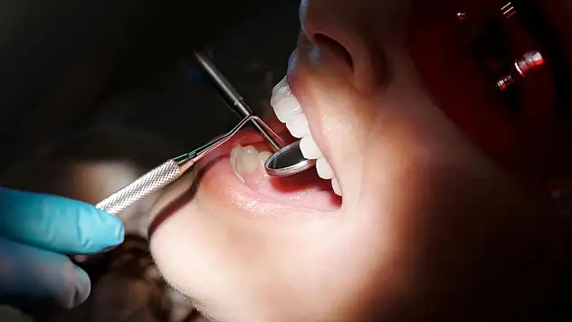 Endomotor ve Dental Mikromotor Arasındaki Farklar