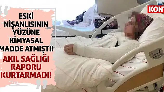 Eski nişanlısının yüzüne kimyasal madde atmıştı! Akıl sağlığı raporu kurtarmadı!