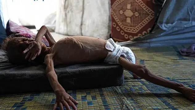 Gazze açlıktan ölmeye devam ediyor: 11 kişi hayatını kaybetti