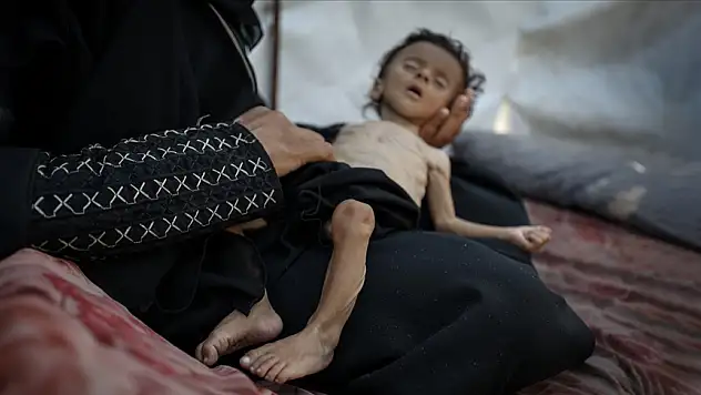 Gazze Şeridi'nde 11 kişi daha açlıktan hayatını kaybetti