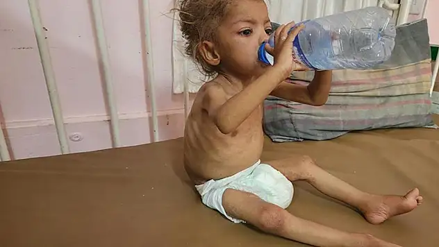 Gazze'de 3 kişi daha açlıktan hayatını kaybetti