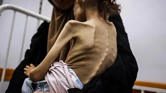 Gazze'de 9 yaşındaki Meryem, 25 kilodan 10 kiloya düştü
