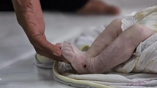 Gazze'de bir bebek daha açlıktan can verdi