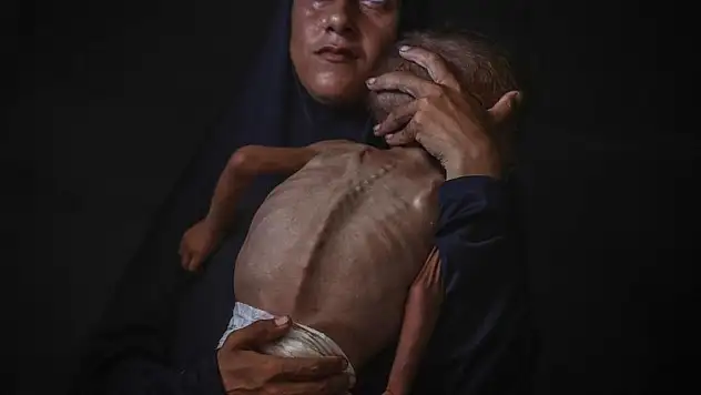 Gazze'de bir bebek daha açlıktan hayatını kaybetti