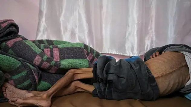Gazze'de bir çocuk daha açlık nedeniyle hayatını kaybetti
