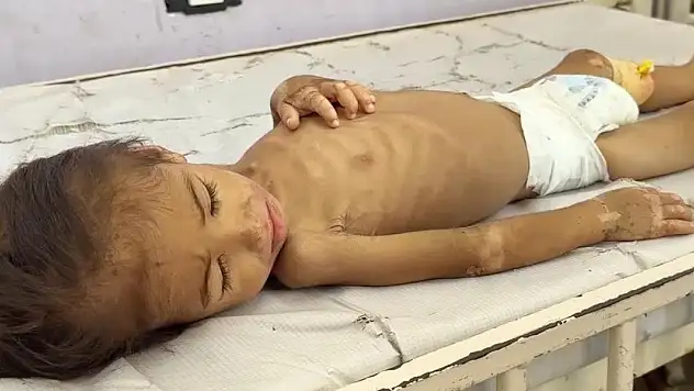 Gazze'de hastanelerdeki çocuklar adeta açlıktan ölümü bekliyor