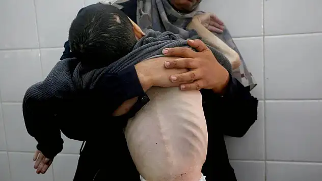 Gazze'de son 24 saatte 2 sivil daha açlıktan hayatını kaybetti