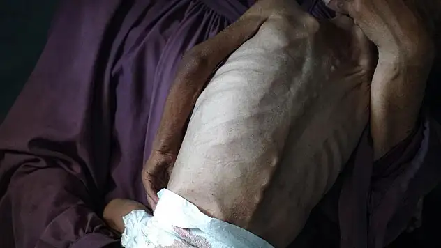 Gazze'de son 24 saatte 3 kişi daha açlıktan hayatını kaybetti