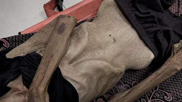 Gazze'de son 24 saatte 5 kişi daha açlıktan hayatını kaybetti