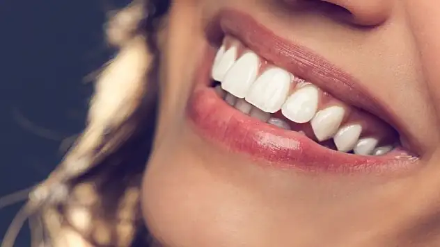 Gülüş Tasarımı Nedir? Estetik ve Özgüvenin Yeni Adı