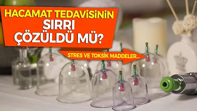 Hacamat Tedavisinin Sırrı Çözüldü Mü? Stres ve Toksik Maddeler…