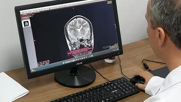 'Her unutkanlık Alzheimer hastalığı değildir'