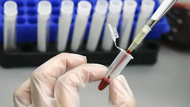 HIV olduğunu eşinden sakladı, 20 yıla kadar hapisle yargılanacak