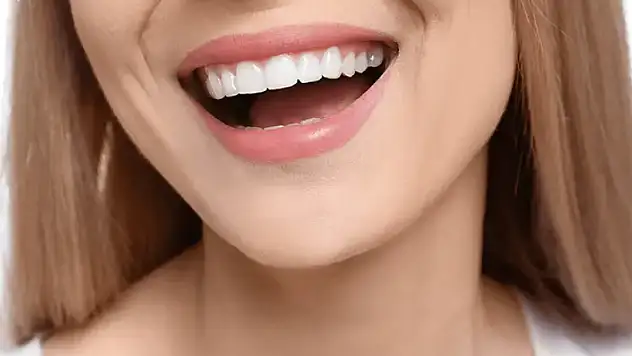 Hollywood Smile & Gülüş Tasarımı Nedir? Mükemmel Gülüşe Açılan Kapı