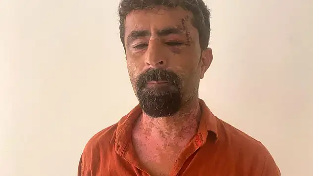 Kan Donduran Olay! Kayınpeder Hastanede, Damat Gözaltında!