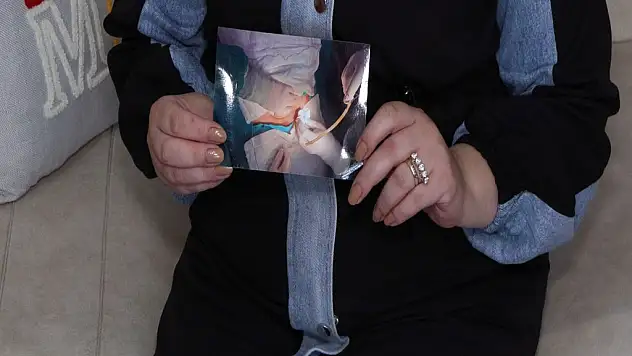 Karnında Hortumla Yaşadı, Doktor Dalga Geçti!