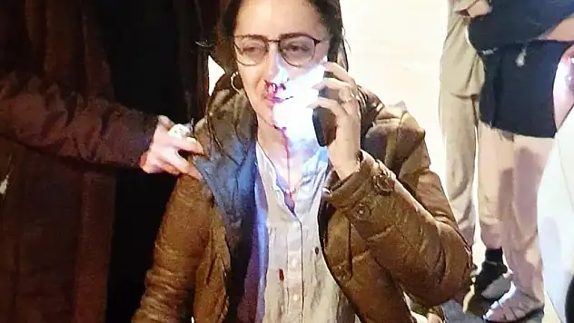 Kendisini eşinin sevgilisi zanneden kadın tarafından darbedildi