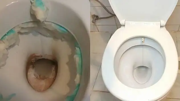 Klozetiniz kir ve leke içerisinde mi? İşte klozeti pırıl pırıl yapacak temizlik yöntemi
