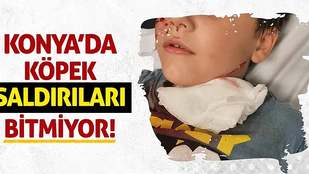 Konya'da köpek saldırıları bitmiyor!