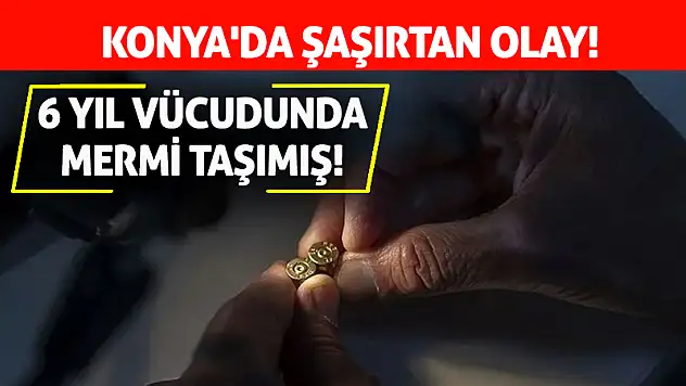 Konya'da Şaşırtan Olay! 6 Yıl Vücudunda Mermi Taşımış!