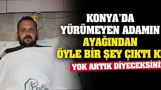 Konya'da yürümeyen adamın ayağından öyle bir şey çıktı ki… Yok artık diyeceksiniz!