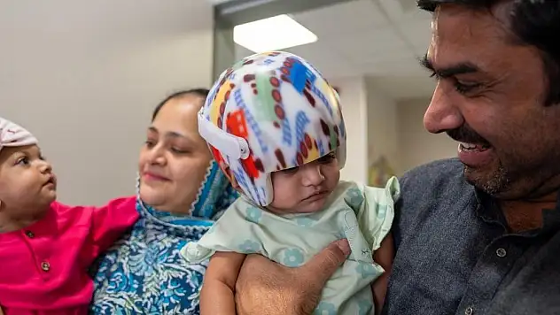Pakistanlı siyam ikizlerine Türkiye'de umut ışığı doğdu