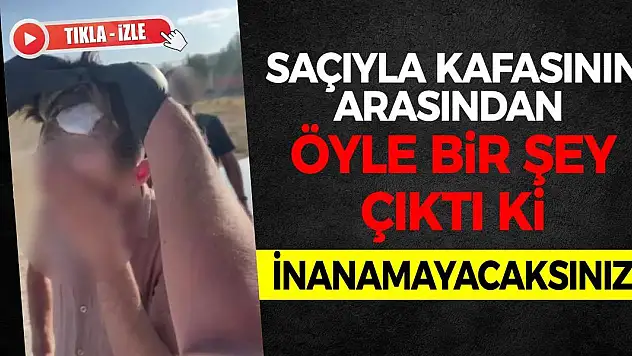 Saçıyla Kafasının Arasından Öyle Bir Şey Çıktı Ki! İnanamayacaksınız!