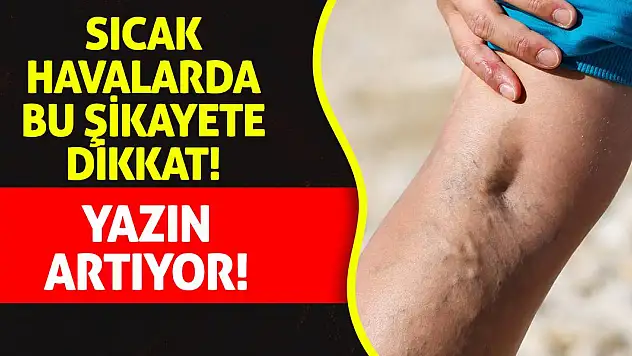 Sıcak Havalarda Bu Şikayete Dikkat! Yazın Artıyor