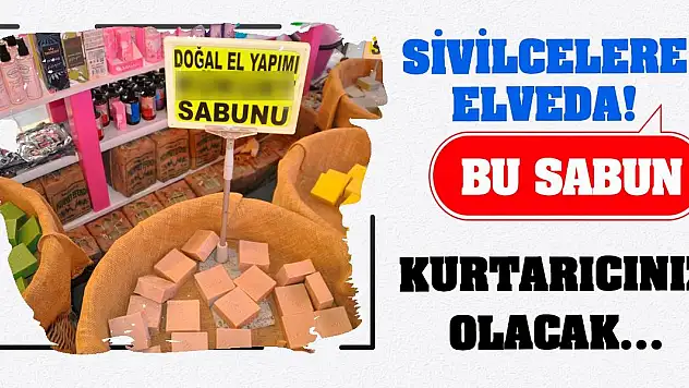 Sivilcelere Elveda! Bu Sabun Kurtarıcınız Olacak…