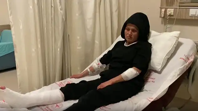 Sokakta yürüyen kadın 3 köpeğin saldırısına uğradı