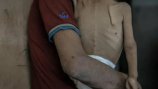 Son 24 saatte 10 Filistinli açlıktan hayatını kaybetti