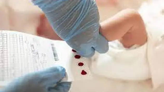 Türkiye'de her 25 kişiden biri fenilketonüri taşıyıcısı