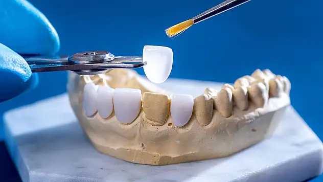 Zirkonyum kaplama ile metal destekli porselen arasındaki temel fark nedir?