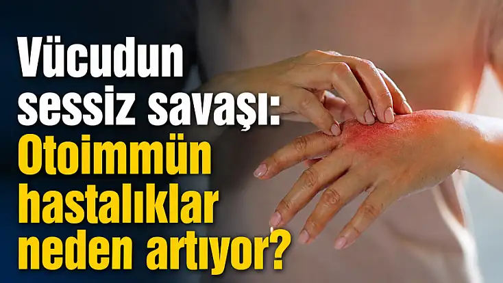 Vücudun sessiz savaşı: Otoimmün hastalıklar neden artıyor?