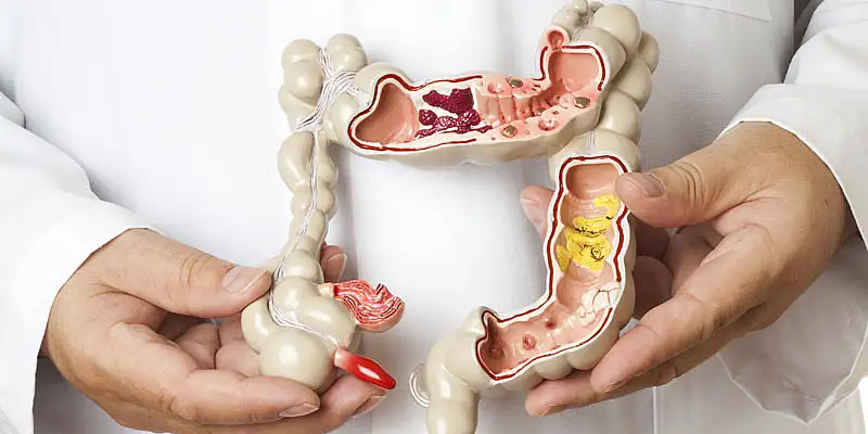 Haber